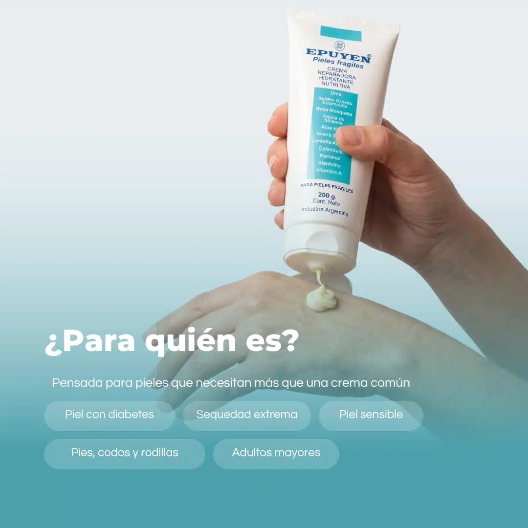Epuyen Pieles Fragiles x 200 g. - Imagen 3