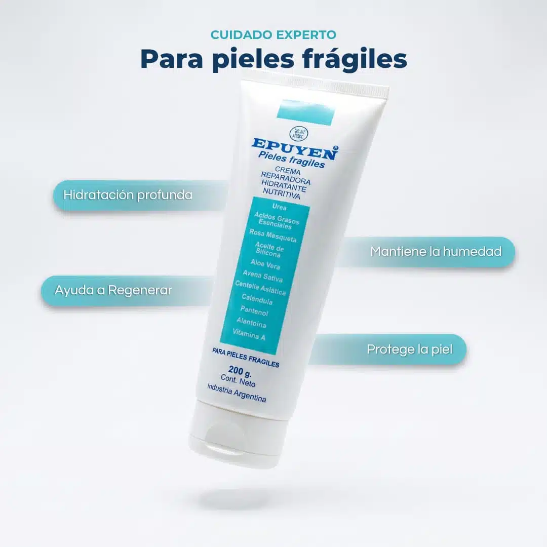 Pieles fragiles 2-5